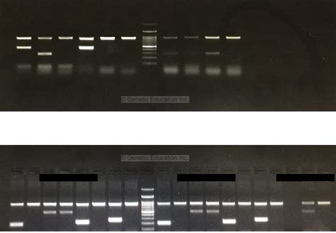 how to improve gel electrophoresis results|How To Read & Interpret Gel Electrophoresis .